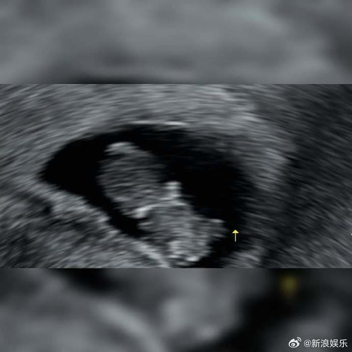 Tweet Image