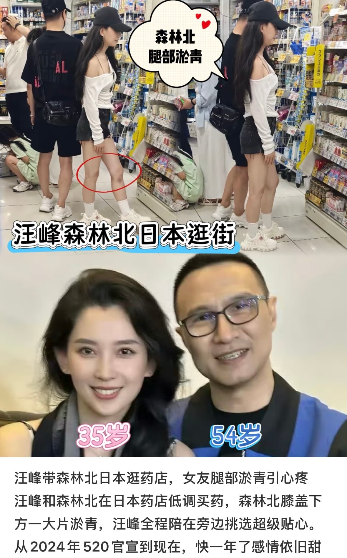 森林北腿部大片淤青疑受伤