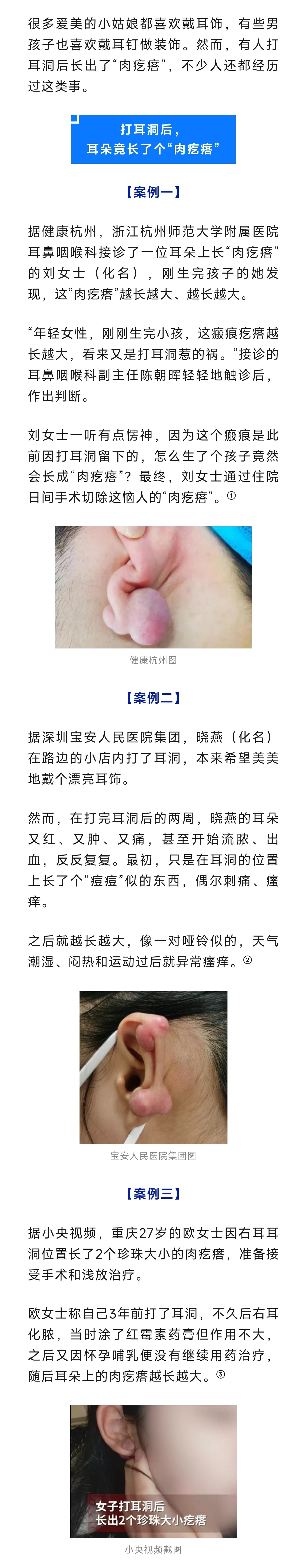 Tweet Image