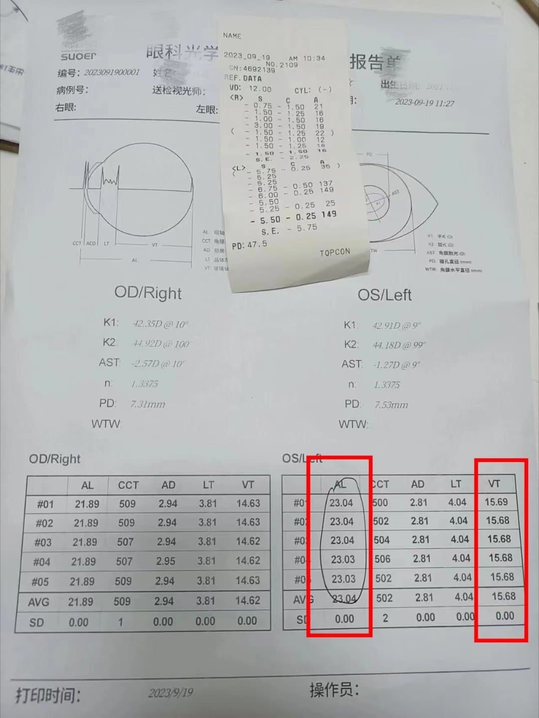 4岁娃查出400度远视加250度散光