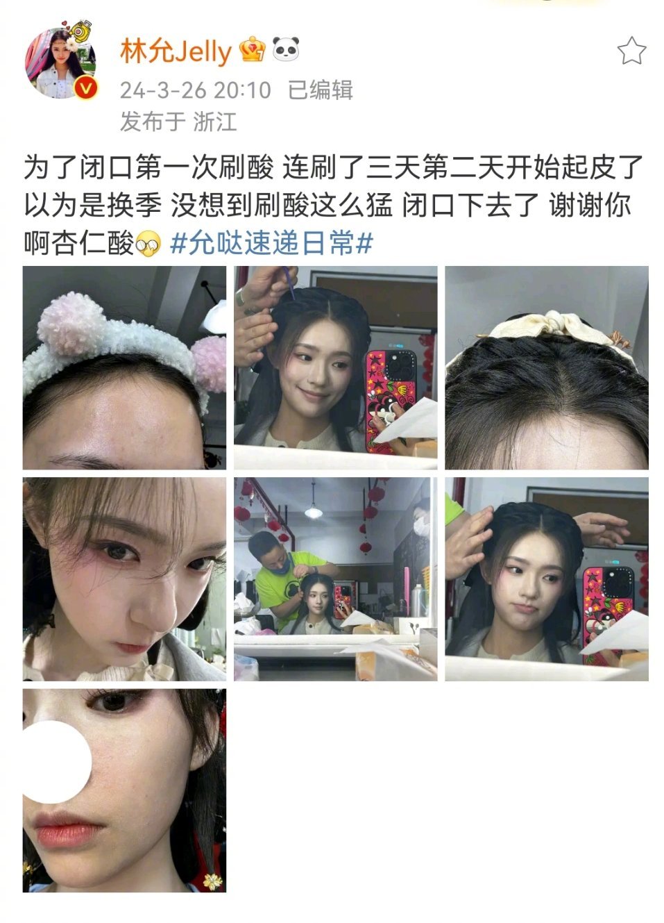 Chinese Social Media Sensation: Users Share Experiences and Debates Cultural Differences Over 'Plum Kernel Acid' Skin Product