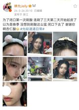 In a recent social media trend, Chinese users have been sharing their experiences of using a facial peeling product, known as '尖杏仁酸'. This trend was initiated by a user named '林允Jelly', who posted about using the product for the first time in order to improve their skin. The post quickly gained popularity on Weibo, with many users sharing their own experiences and tips for using the product. One user, '啊杏仁酸', shared their experience of using the product for three days, resulting in their skin beginning to peel. They expressed their surprise at the intensity of the product, stating "I thought it was just a change of season, but I didn't expect the peeling to be so strong.