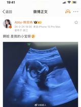 In a recent social media post, Chinese actress Han Anran, also known as Abby, shared an ultrasound image of her second child, causing a stir among netizens. The post, which was accompanied by the caption "Ah, it's my little treasure," quickly gained traction on Weibo, with many users expressing their congratulations and well-wishes for the actress.