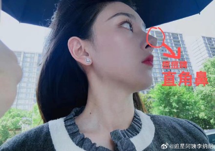 Song's right-angled nose