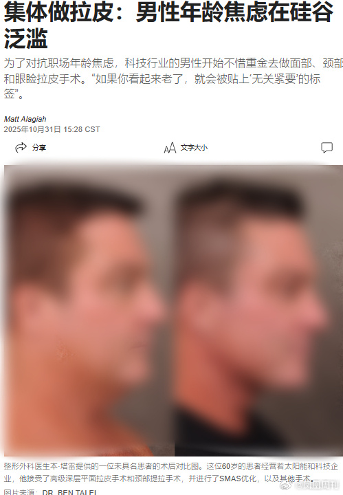 A Silicon Valley report on tech workers and facelifts, reproduced in Phoenix Weekly's feature. Photo: @凤凰周刊