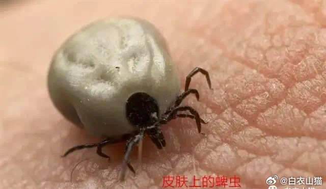 One Tick Bite, 28 Days in the ICU: A Forest Encephalitis Case Puts Hikers on Alert