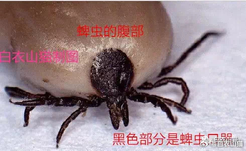 A close-up of a tick's abdomen, with the black mouthparts labeled — the part that must not be left in the skin. Photo: @白衣山猫