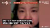 A disturbing incident occurred at Anhui Anqing Municipal Hospital, where a woman died after falling from the 11th floor of the hospital building, five days after undergoing a tooth extraction procedure. The patient's family alleged that the doctor had mistakenly extracted the wrong tooth, leading to the woman's death. The incident sparked widespread public concern and raised questions about the hospital's and doctor's responsibility.