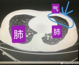 The news of Chen Xingyun, a 38-year-old single mother and anti-cancer blogger, passing away has sent shockwaves throughout the online community. Chen, who was diagnosed with late-stage colorectal cancer in March 2023, had been sharing her experiences and struggles with the disease on social media, inspiring countless people with her optimistic and courageous attitude. Despite her poor health, Chen continued to update her followers on her condition, offering a glimpse into the daily life of a cancer patient and the emotional turmoil that comes with it.
