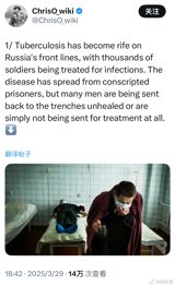A mysterious virus has been detected in Russia, with patients exhibiting symptoms such as coughing with blood and high fever, despite testing negative for COVID-19 and flu. Medical experts are working to identify the source and develop treatments, while a Russian expert cautions against panic, suggesting that the symptoms could be related to other factors.