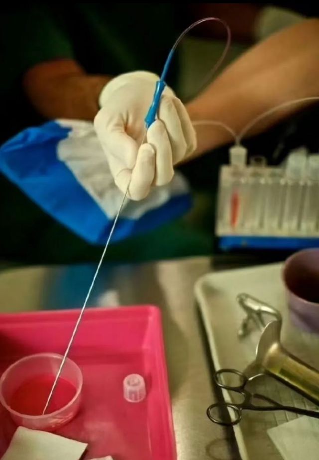 Debunking the Myth: Doctors Say Eating Ice and Spicy Food During Menstruation is Safe