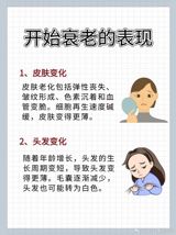 As the world observes World Sleep Day, a growing chorus of medical professionals is advising individuals to rethink their approach to sleep. Gone are the days of forcing oneself to sleep; instead, the mantra now is to sleep only when the body truly desires it. This seemingly counterintuitive advice is particularly aimed at those struggling with insomnia or poor sleep quality, emphasizing the importance of not obsessing over sleep. The underlying principle is rooted in the understanding that sleep is a natural process that should not be coerced. By adopting a more relaxed attitude towards sleep, individuals can potentially improve the quality of their rest and overall well-being.