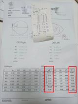 A post on Weibo about a four‑year‑old who was found to have 400 diopters of hyperopia and 250 diopters of astigmatism sparked a wave of commentary that quickly turned the individual case into a national conversation about children’s eye health. The child’s diagnosis, described in Chinese as “4岁娃查出400度远视加250度散光,” – literally, “a four‑year‑old child was diagnosed with 400 degrees of farsightedness and 250 degrees of astigmatism” – sounded an alarm bell for parents across the country.