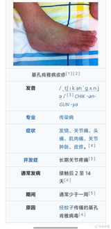 An outbreak of Chikungunya fever in the Shunde District of Foshan, China, has garnered significant attention, with 478 confirmed cases as of July 15, 2023. This sudden spike in a mosquito-borne illness, particularly during the high-risk season characterized by high temperatures and rainfall, has sparked a mix of concern, calls for public health action, and a focus on preventive measures among the public.